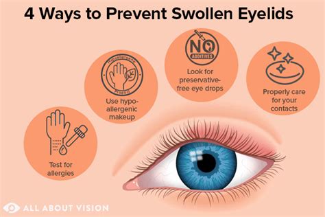 Makeup Causes Swollen Eyelids Saubhaya Makeup