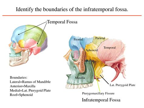 A bone spur is a small, sharp outgrowth of bone. 8b. Osteology of the Head and Neck II - Gross Anatomy with ...