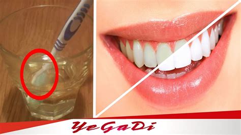 Homemade Natural Teeth Whitening With Just One Ingredient 3 Minute