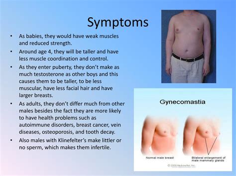 Ppt Klinefelters Syndrome Powerpoint Presentation Free Download Id1676966
