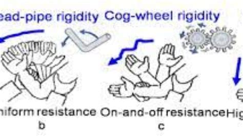 Cogwheel Rigidity