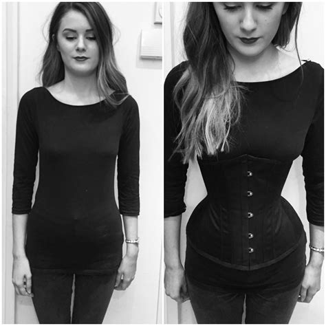 Eloise Before And After She S Wearing A Handmade Waist Trainer By