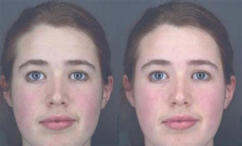 Rosy Complexion Is Sign Of Health Live Science