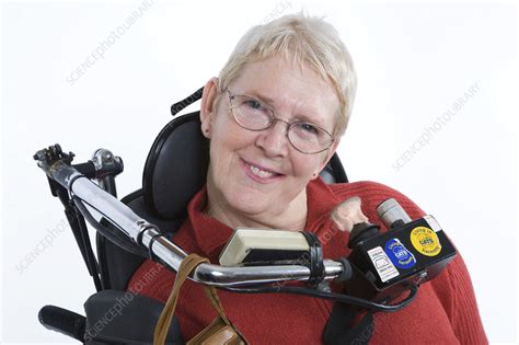 Portrait Of A Woman With Cerebral Palsy Stock Image C