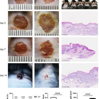 Extraction And Identification Of UC MSC Exo A Expression Of