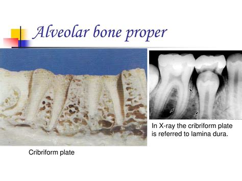 Ppt Pre Clinical Periodontics Powerpoint Presentation Free Download