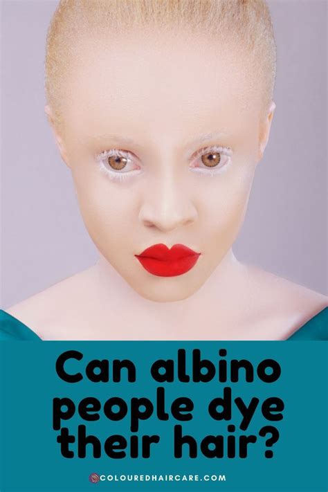 Can Albino People Dye Their Hair Mystery Solved Albino Hair Colour