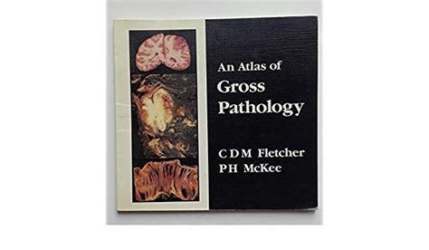 An Atlas Of Gross Pathology By C D M Fletcher Ebook Pdf Download