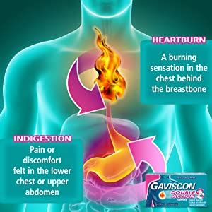 What does it feel like when food is stuck in your throat? Gaviscon Peppermint Liquid Relief Oral Suspension for ...