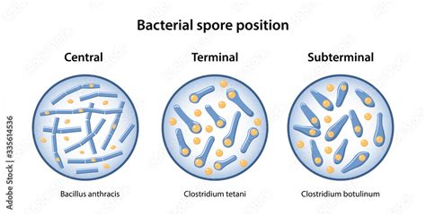 Vettoriale Stock The Position Of Bacillus Spores Central Terminal