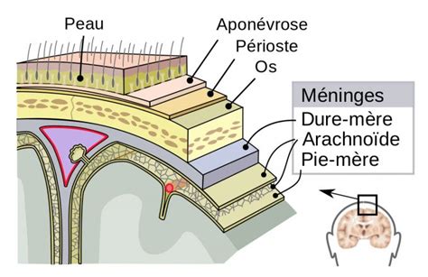 Syndrome Méningé Symptômes Contagion Causes Traitements