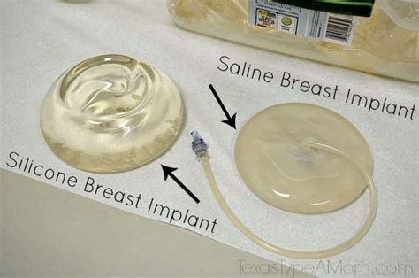 350cc saline breast implants before and after dd