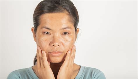 4 Signs Of Aging Caused By Sun Damage Puristry
