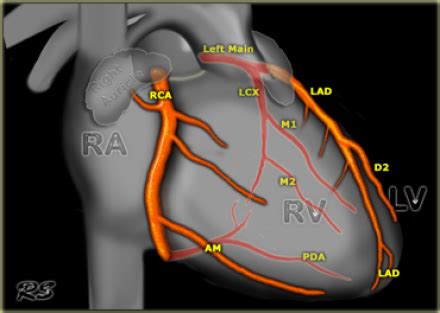 Termination of left anterior descending. Coronary Arteries Pictures | eNetMD