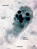 Entamoeba histolytica trophozoite | Medical Laboratories