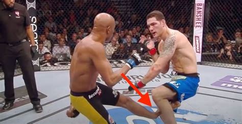 Top 10 Worst Ufc Injuries Ever That Are Disgusting Sportytell