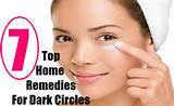 Images of Home Remedies Dark Circles Around Eyes