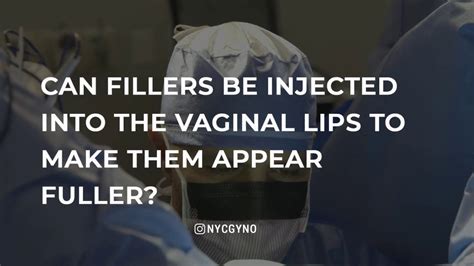 Can Fillers Be Injected Into The Vaginal Lips To Make Them Appear