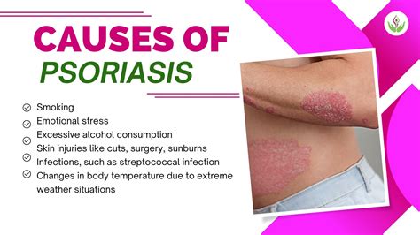 Psoriasis Unveiled Causes Types Symptoms And Solutions Care Well Medical Centre