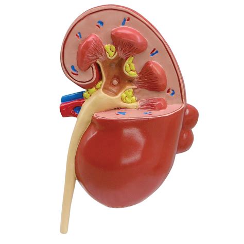 Diseased Kidney Model 1019550 3260 Anatomical Models Anatomy