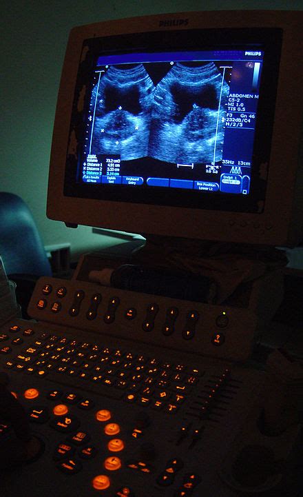 Medical Ultrasound Wikipedia