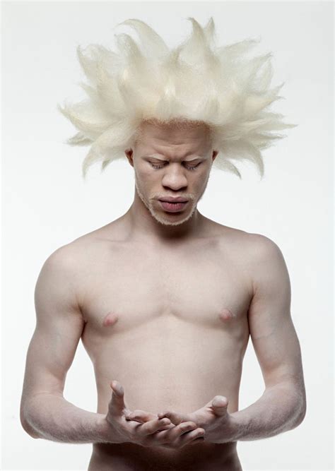22 Pessoas Albinas Que Vão Hipnotizá Lo Com Sua Beleza De Outro Mundo