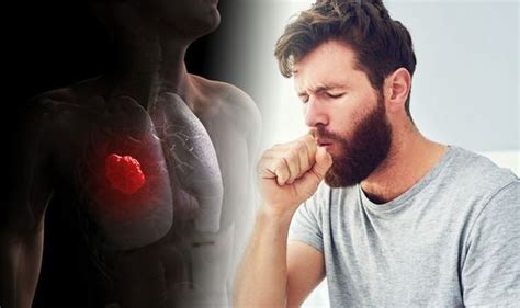 Lung Cancer Symptoms A Persistent Cough Which Lasts Two Or Three Weeks
