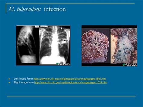 Ppt Mycobacterium Tuberculosis Powerpoint Presentation Free Download Id320637