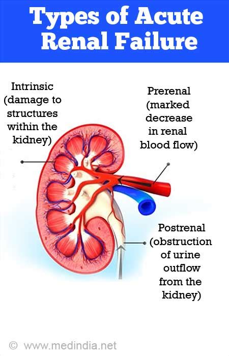 Acute Renal Failure Arf Acute Kidney Injury Pipeline Review H2