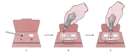 Fecal Occult Blood Test Methods Principle Procedure Clinical