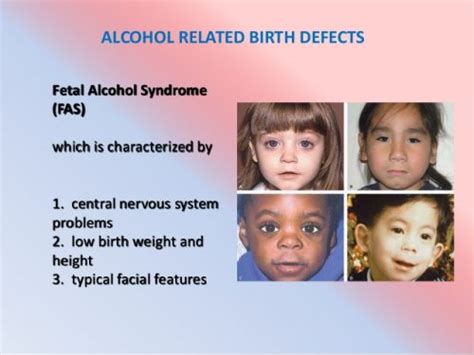 Fetal Alcohol Spectrum Disorder Chemical Dependency Counseling