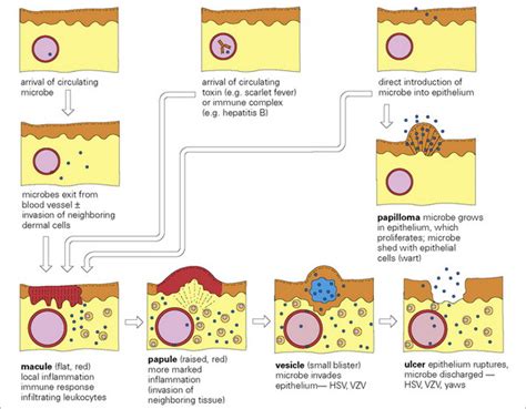Infections Of The Skin Soft Tissue Muscle And Associated Systems