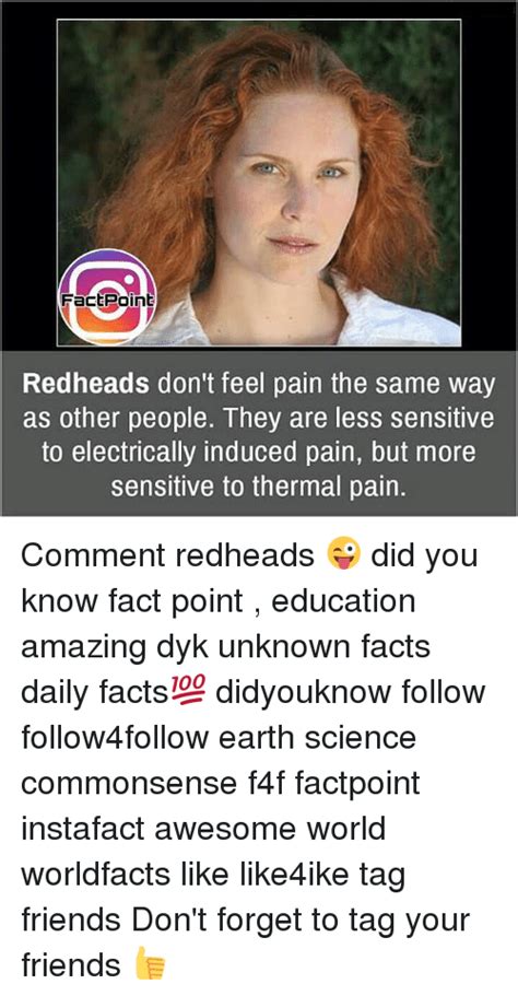 Factpoint Redheads Don T Feel Pain The Same Way As Other People They Are Less Sensitive To
