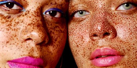 Melanin Types Benefits And How To Increase Production