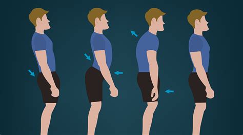 How To Improve Posture For A Straight And Healthy Back Drsumitz Clinic