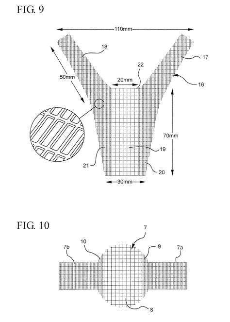 Patent Us Method Of Surgical Repair Of Vagina Damaged By