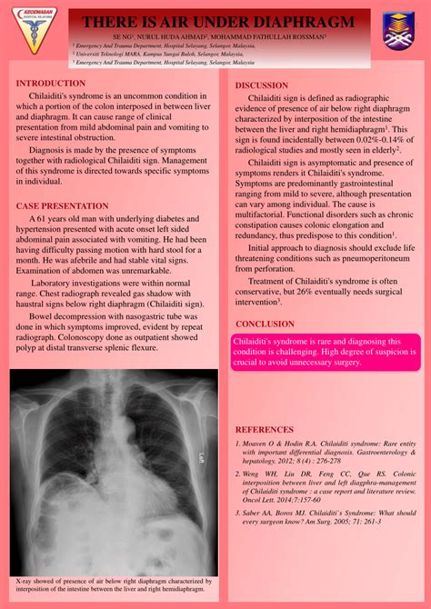 Pdf There Is Air Under Diaphragm