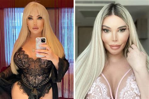 Jessica Alves Formerly Known As The Human Ken Doll Has Finished Her Transition