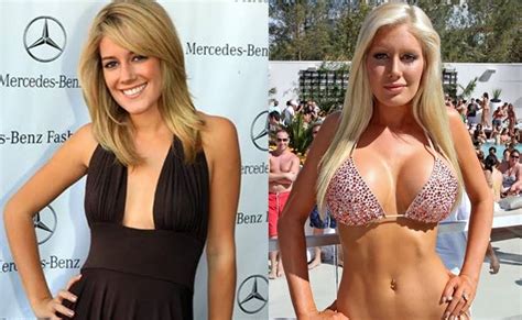 The Ever Changing Look Of Heidi Montags Before And After Plastic