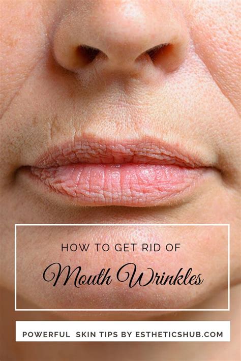 How To Get Rid Of Wrinkles Around Your Mouth And Lips Naturally