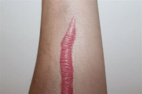 Hyper Realistic Thick Raised Keloid Scar Silicone Prosthetic Etsy