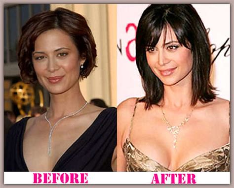Catherine Bell Plastic Surgery Before After The Catherine Flickr