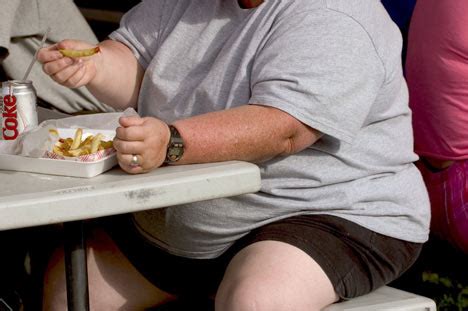 Obese That S Because You Eat Too Much Says Top Doctor Daily Mail Online