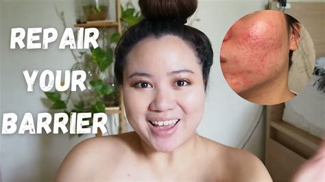 How To Repair Skin Barrier On Face Simple And Affordable Skincare Advice Youtube