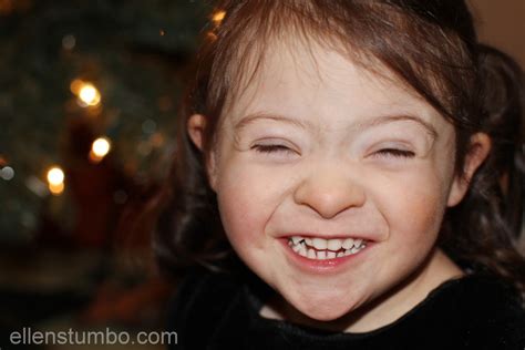 A Closer Look At The Physical Characteristics Of Down Syndrome Ellen