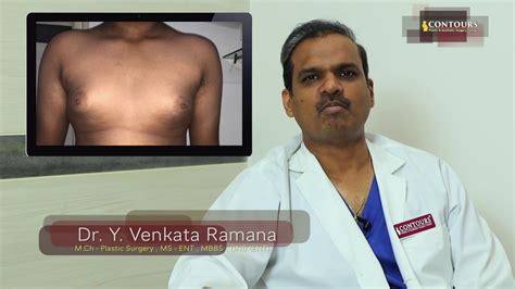 Gynaecomastia Male Breast Part 1 Dr Venkatramana Yamini YouTube