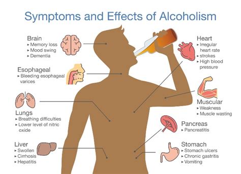 Alcoholic Related Liver Diseases Gastroenterologist In Flemington