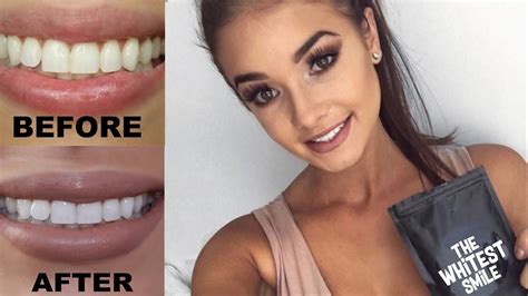 How To How To Get White Teeth Guaranteed Effect Up To 5 Shades Whiter