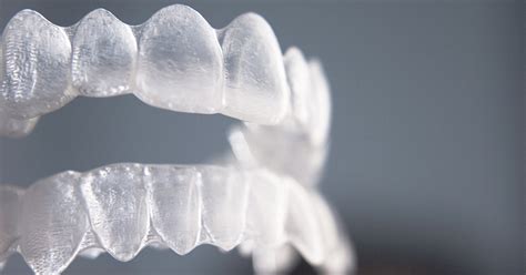 These kinds of retainers should be worn all of the time for a minimum of one year after the braces have come off. How to Clean Retainers: Tips and Tricks