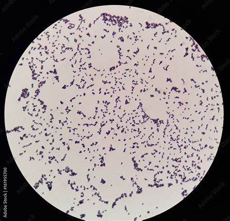 Smear Of Gram Positive Cocci Bacteria Under 100x Light Microscope